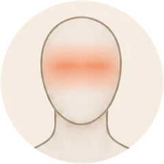 The warm area on the eyes