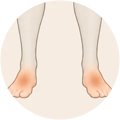 The warm area on the feet