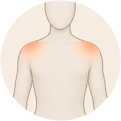 The warm area on the shoulders